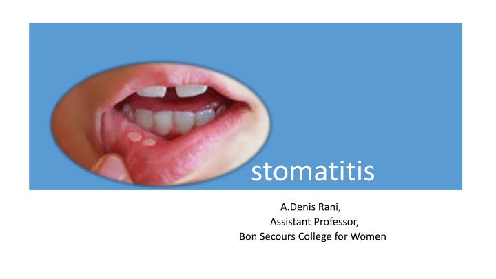 stomatitis