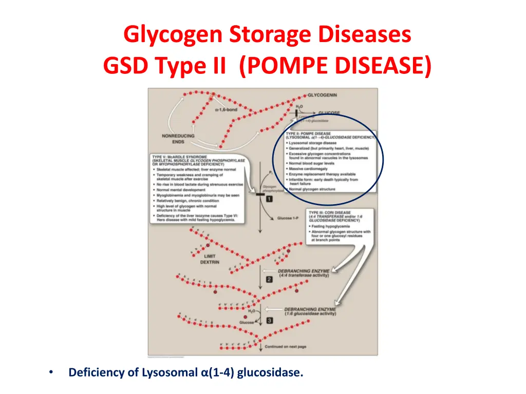 glycogen storage diseases gsd type ii pompe