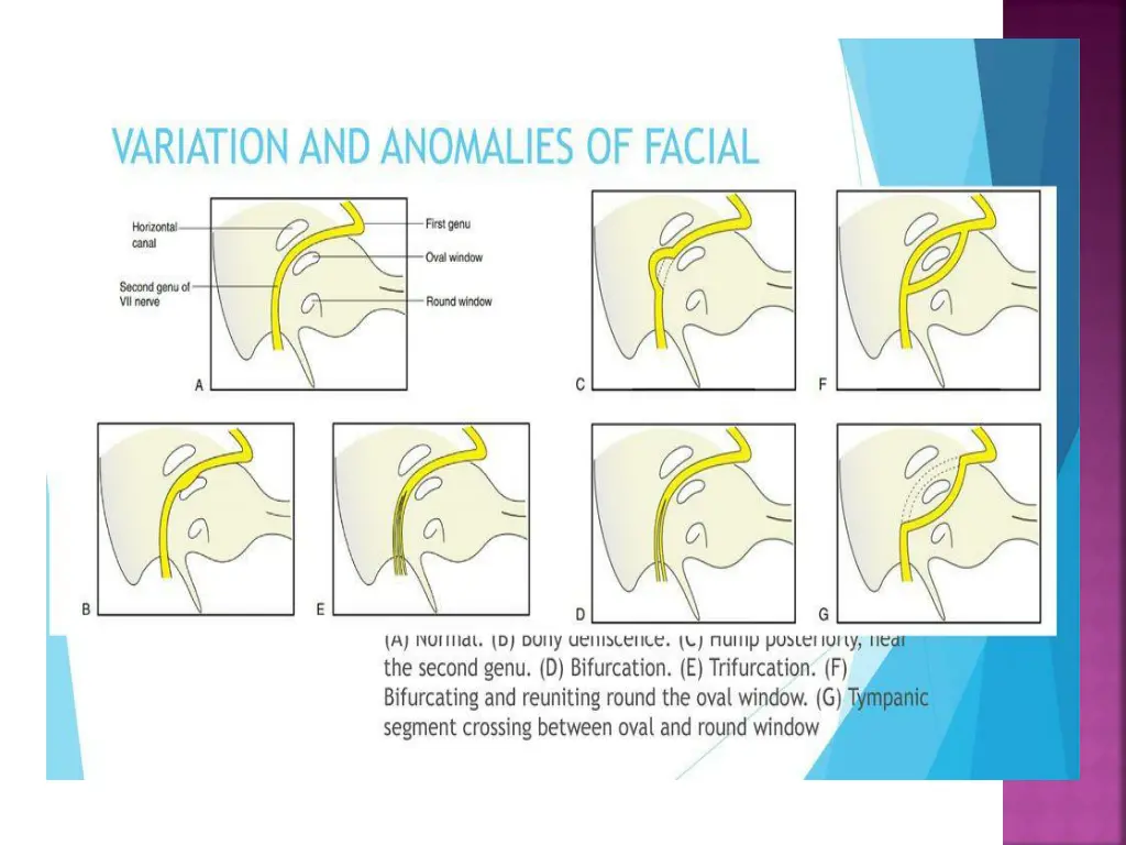 slide25