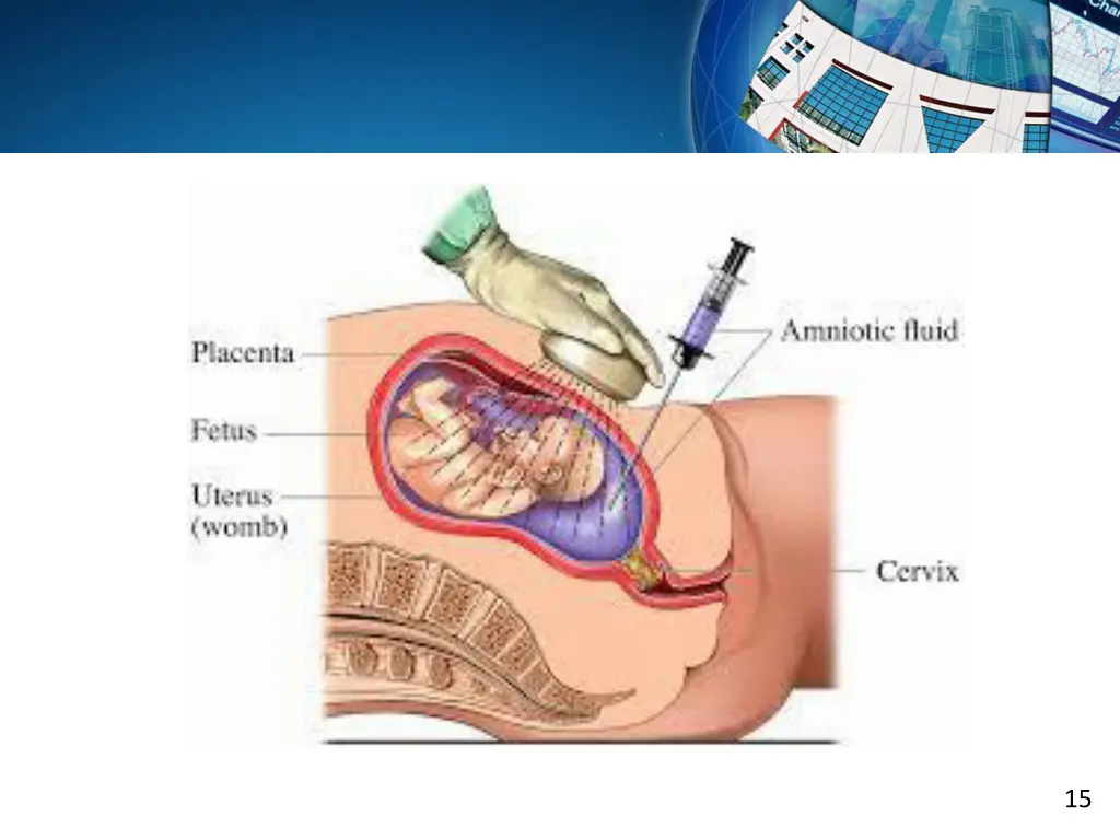 slide15