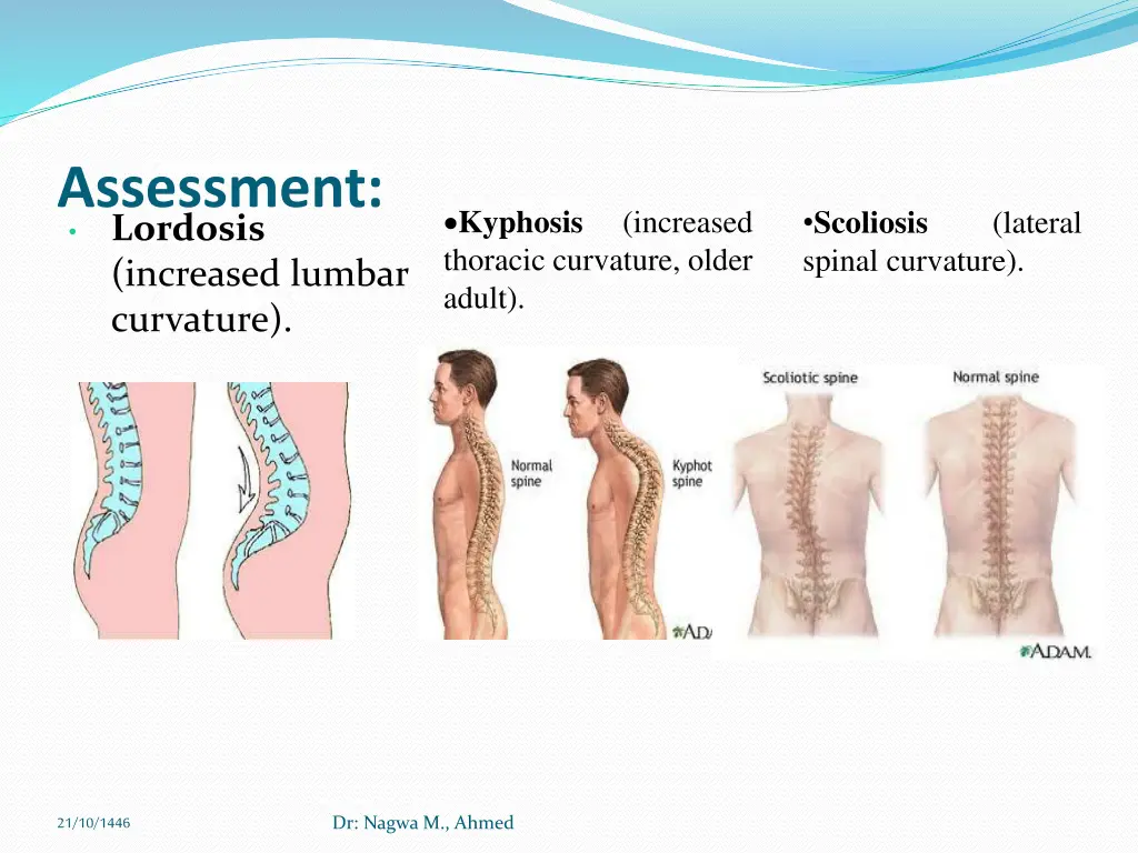 assessment lordosis increased lumbar curvature