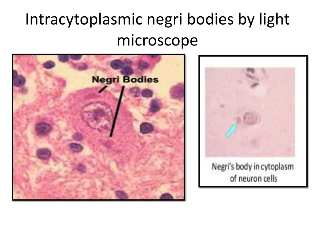 intracytoplasmic negri bodies by light microscope