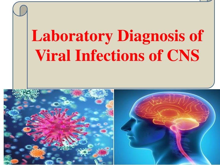 laboratory diagnosis of viral infections of cns