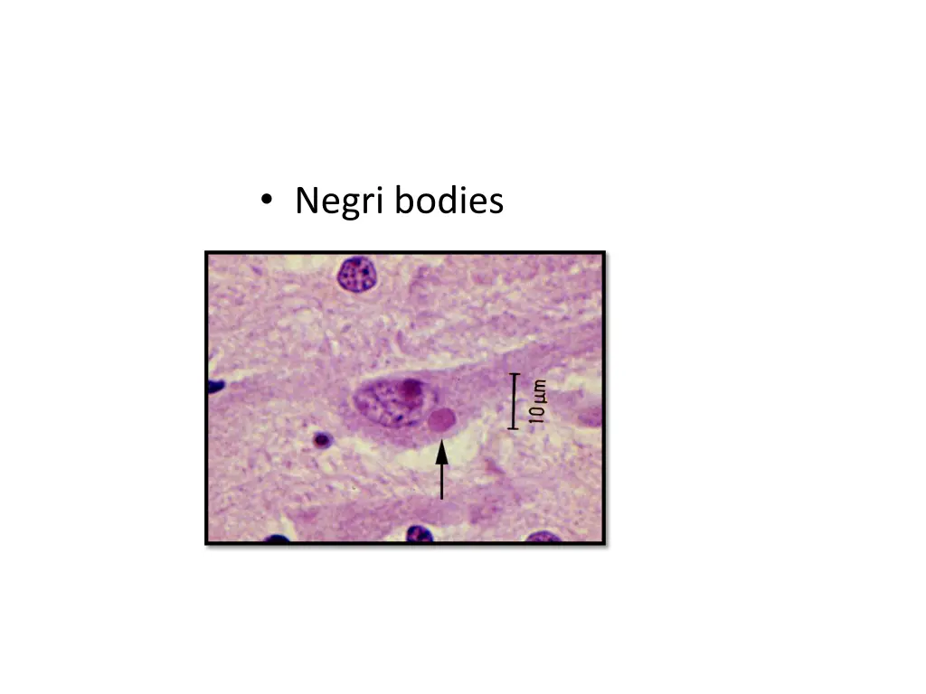 negri bodies