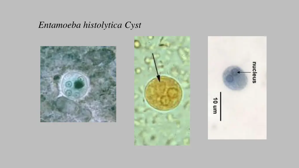 entamoeba histolytica cyst