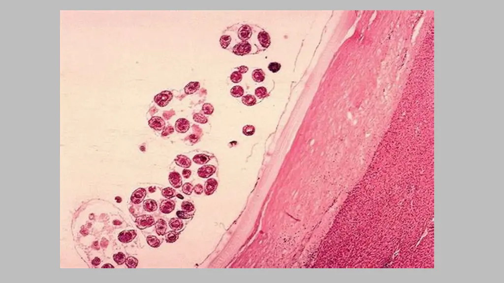 slide13