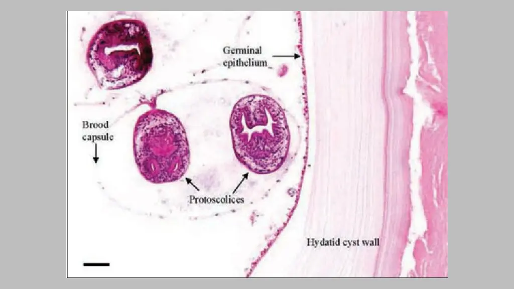 slide14
