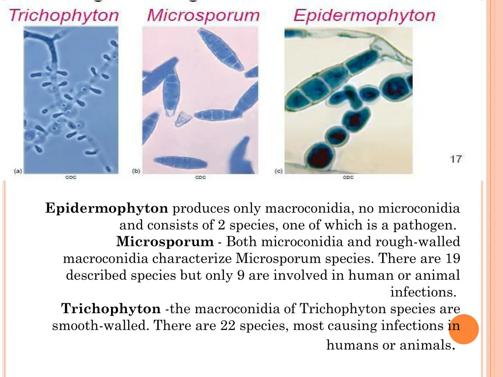 epidermophyton produces only macroconidia