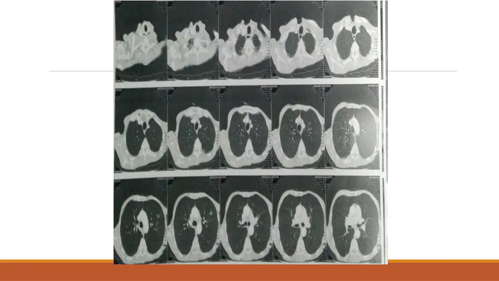 slide20