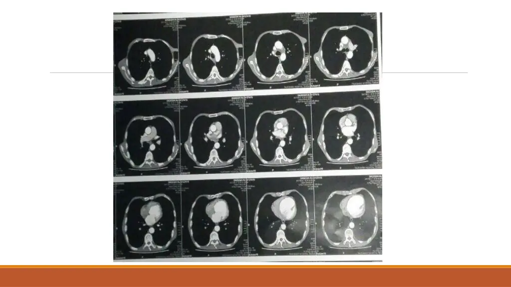 slide21