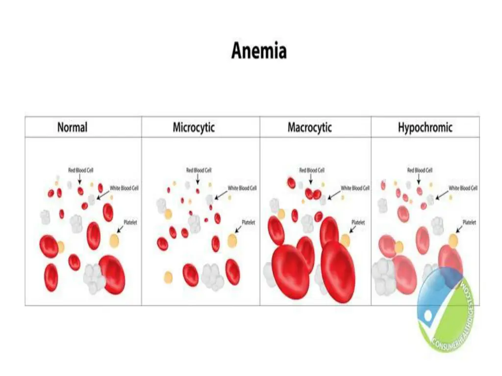 slide11