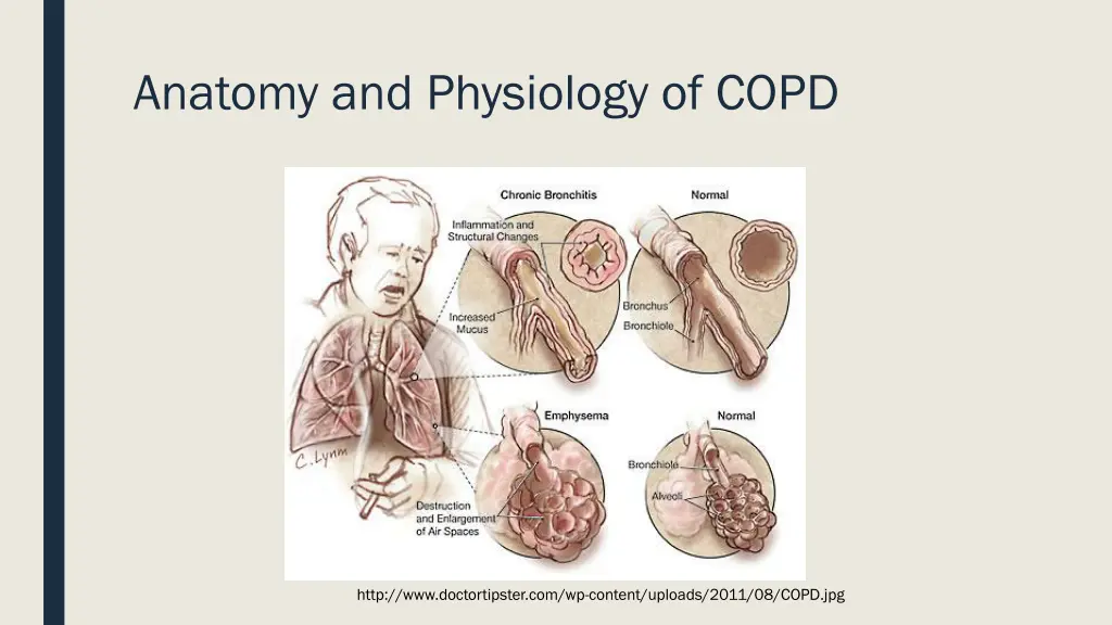 anatomy and physiology of copd