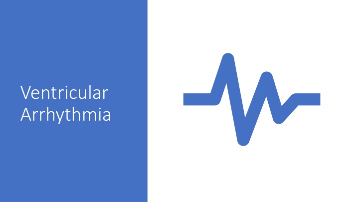 ventricular arrhythmia