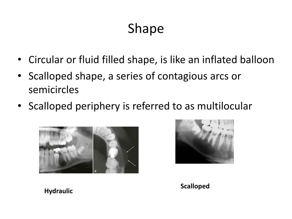 shape