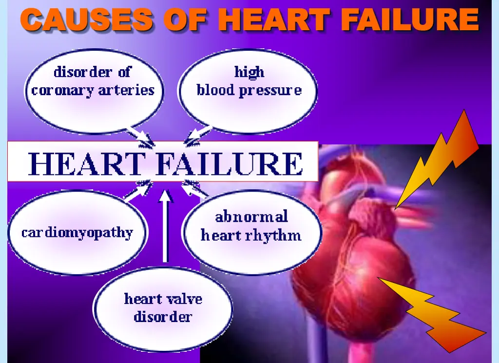 causes of heart failure causes of heart failure