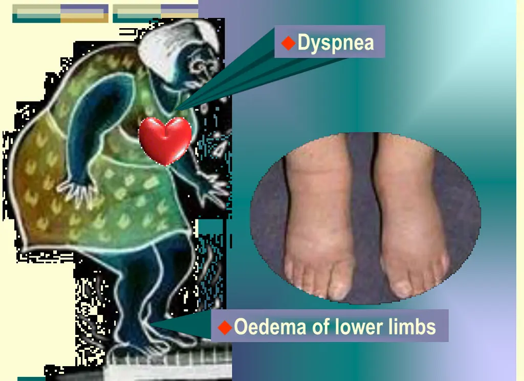 dyspnea