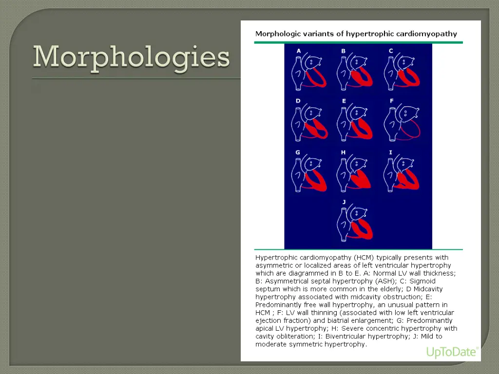 slide3
