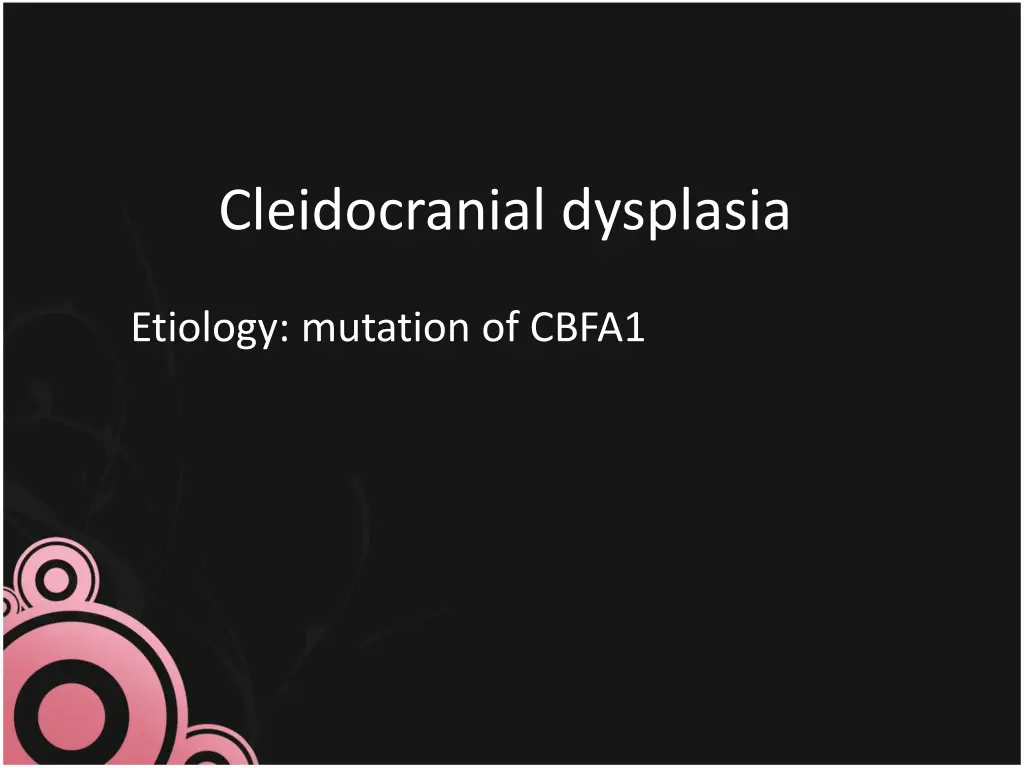 cleidocranial dysplasia