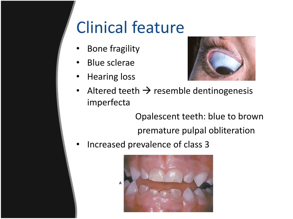 clinical feature