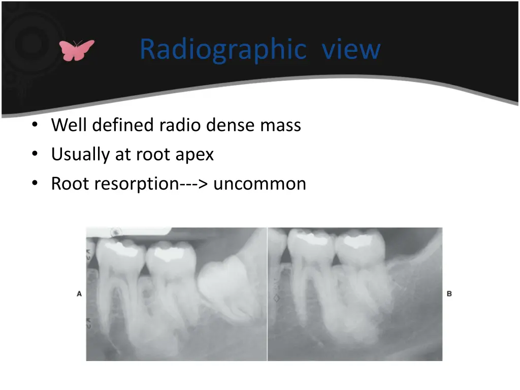 radiographic view 1