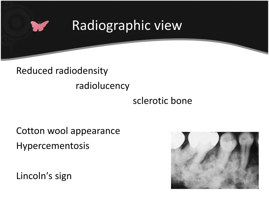 radiographic view 2