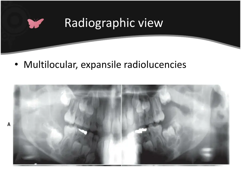 radiographic view 4