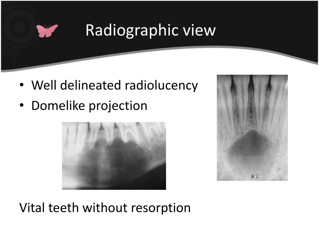 radiographic view 5