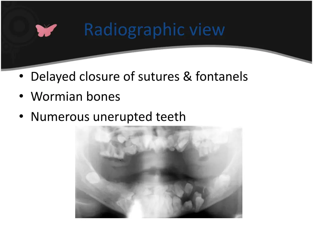 radiographic view