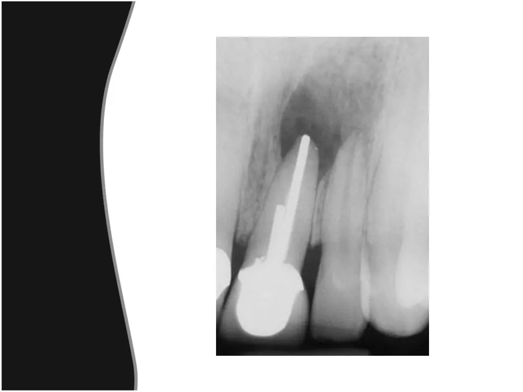 slide31