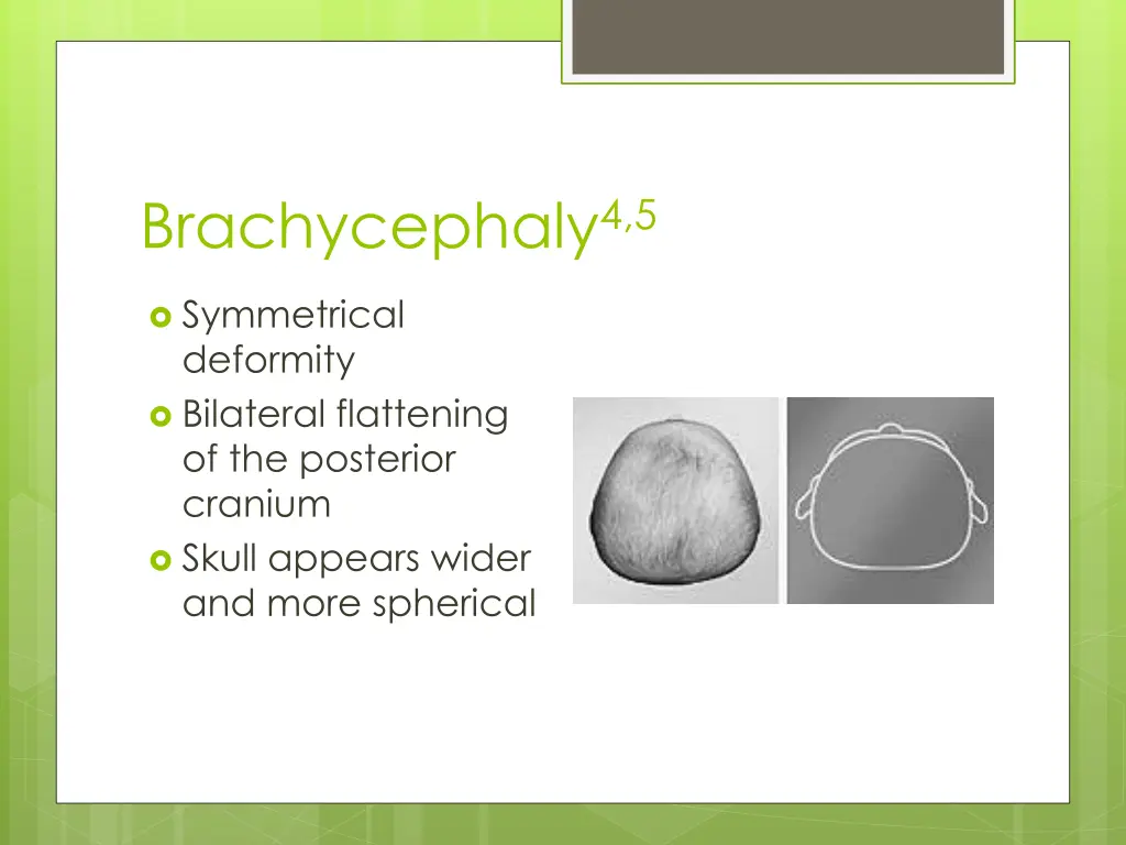 brachycephaly 4 5
