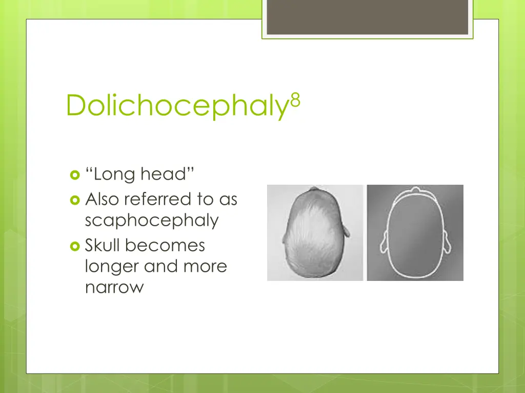 dolichocephaly 8