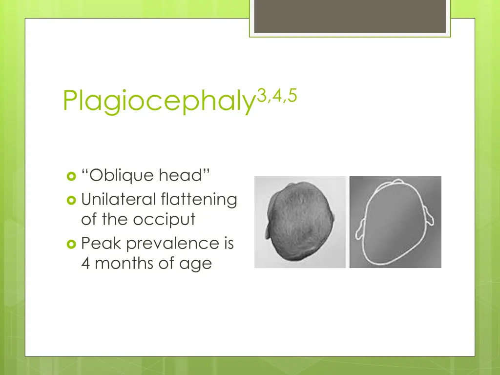 plagiocephaly 3 4 5