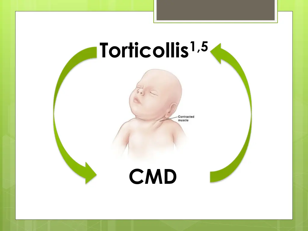 torticollis 1 5