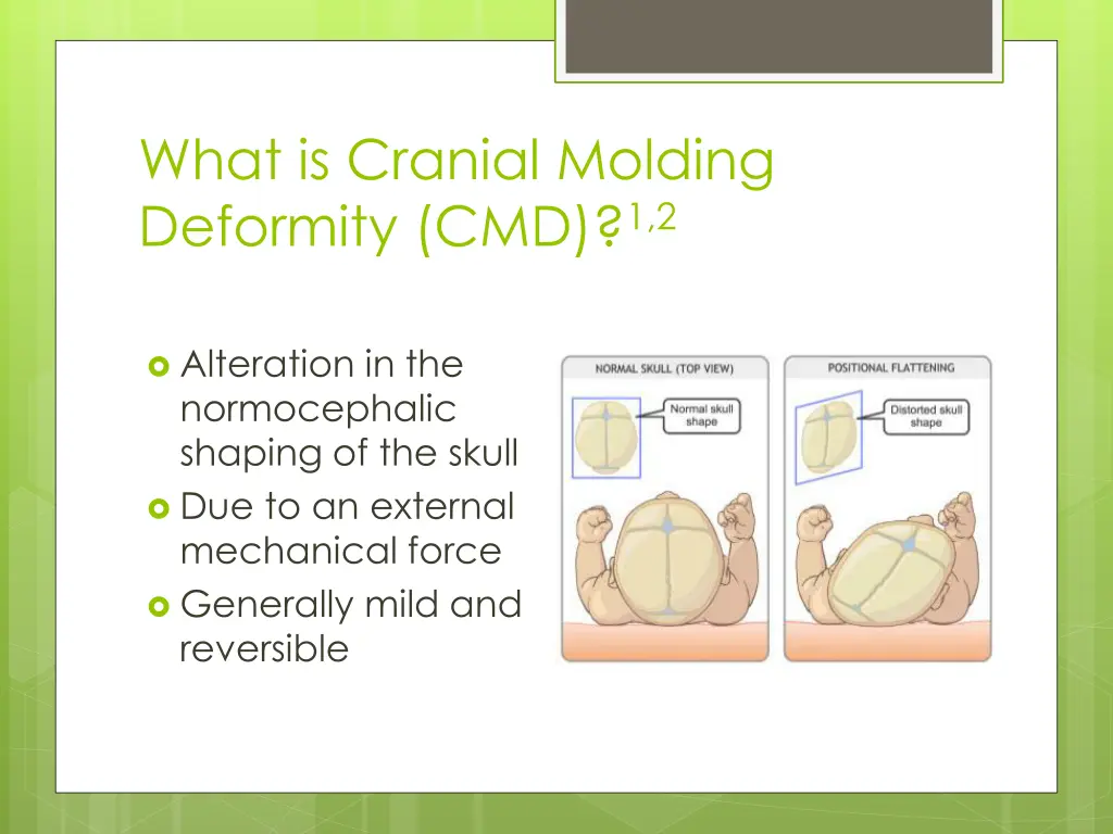 what is cranial molding deformity cmd 1 2