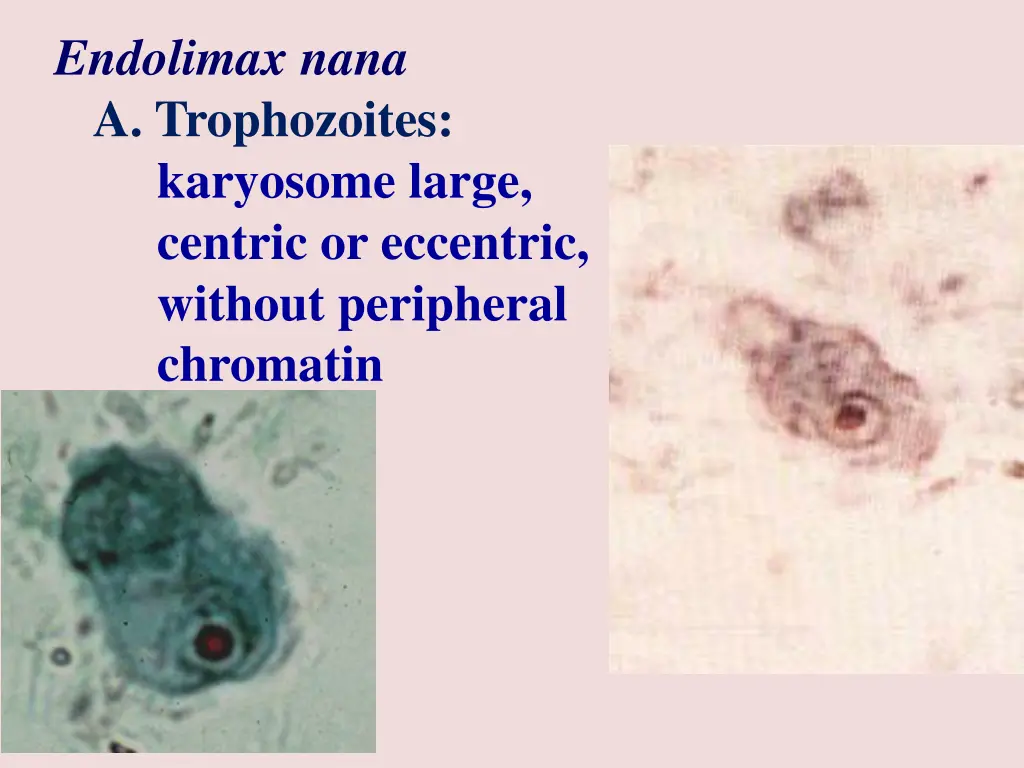 endolimax nana a trophozoites karyosome large
