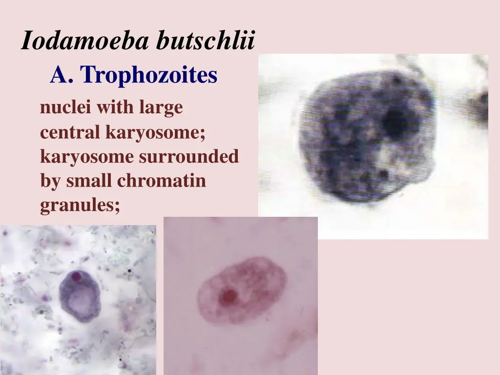 iodamoeba butschlii a trophozoites nuclei with