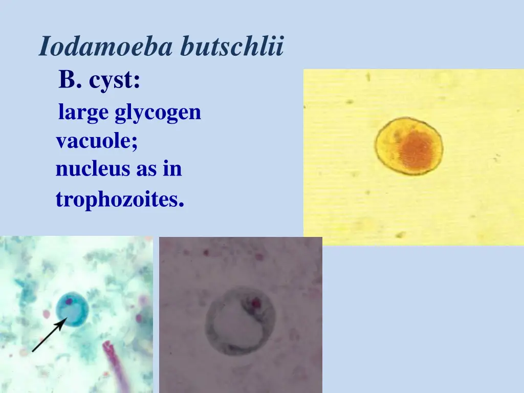 iodamoeba butschlii b cyst large glycogen vacuole