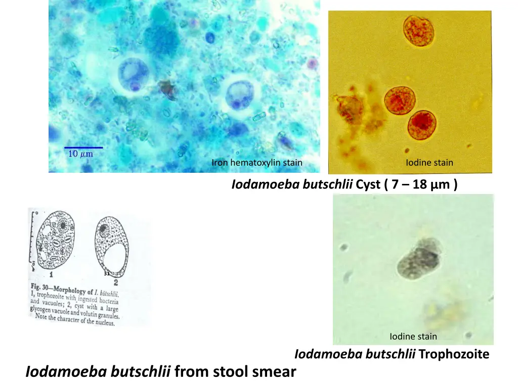 iron hematoxylin stain