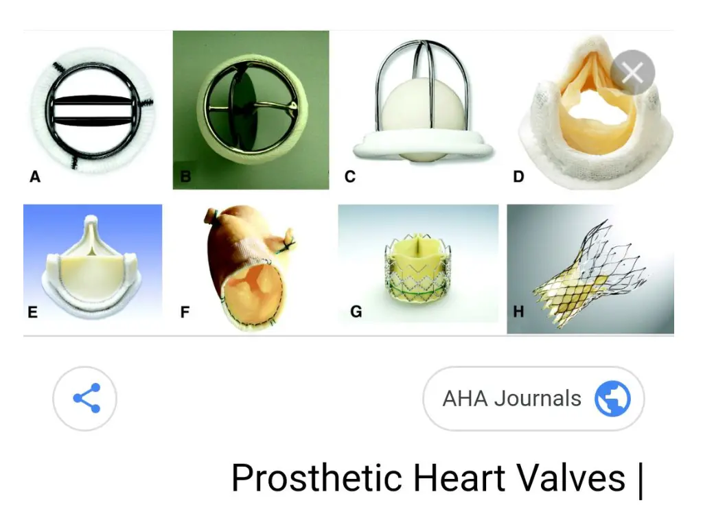 slide14