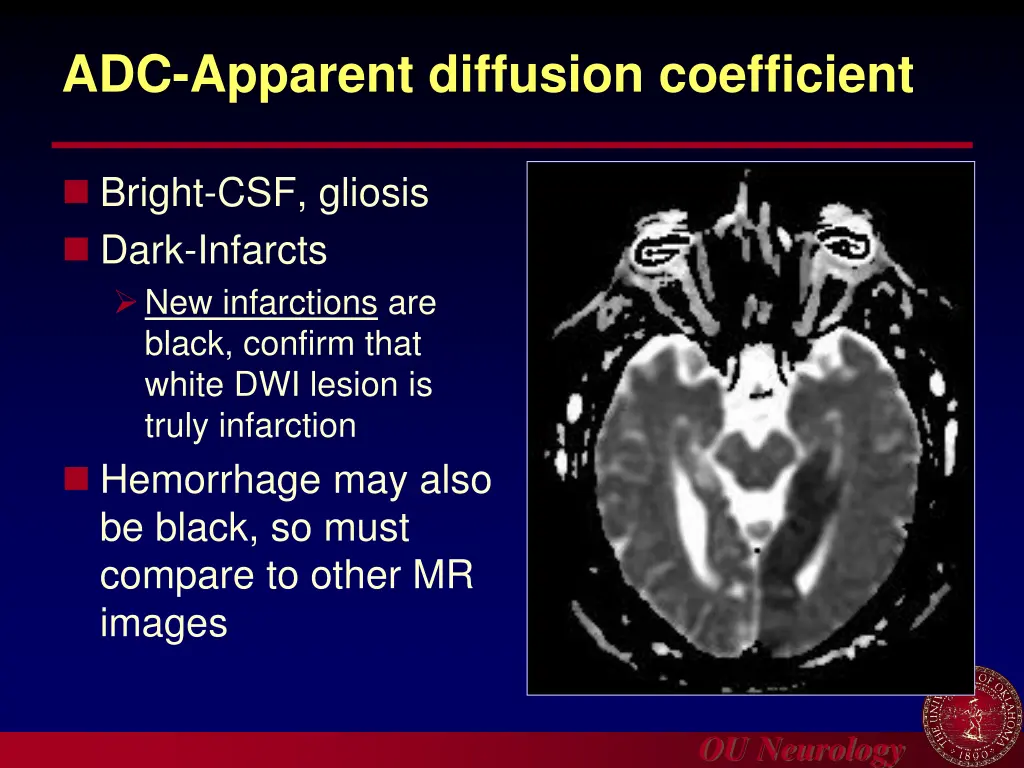 adc apparent diffusion coefficient