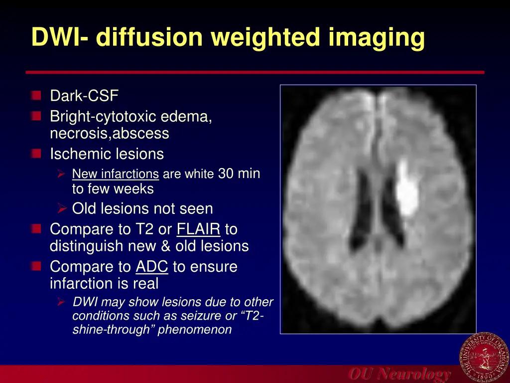 dwi diffusion weighted imaging