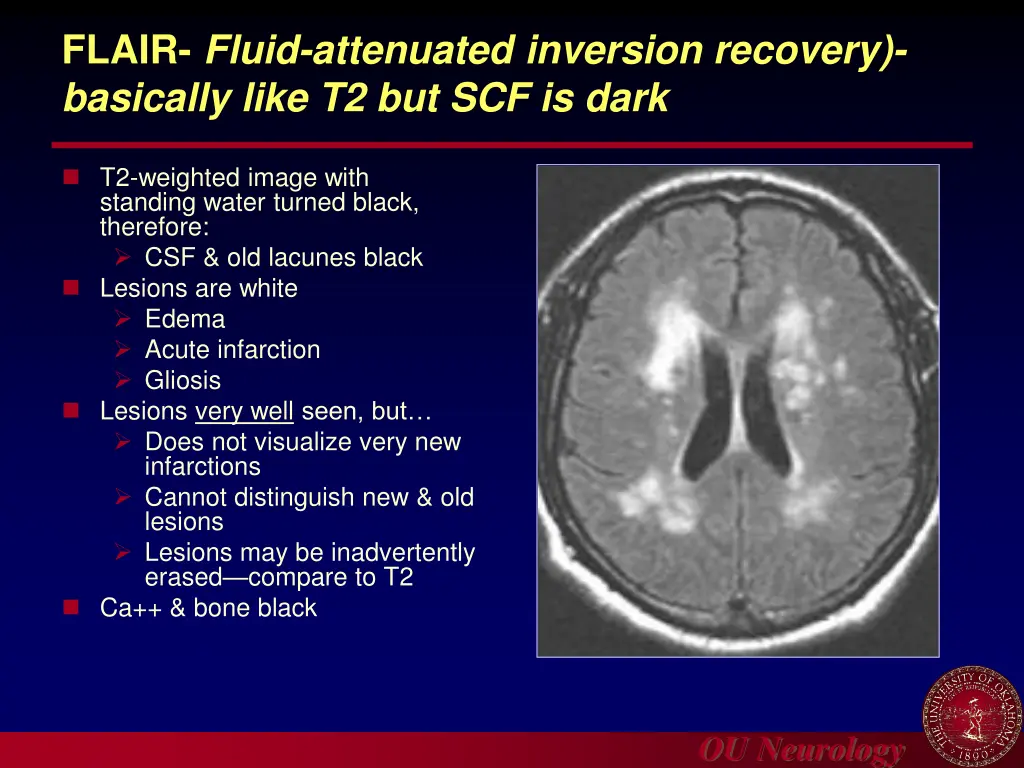 flair fluid attenuated inversion recovery