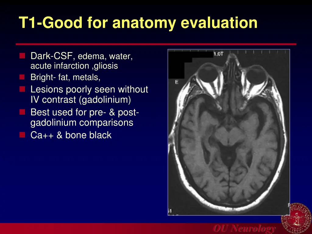 t1 good for anatomy evaluation