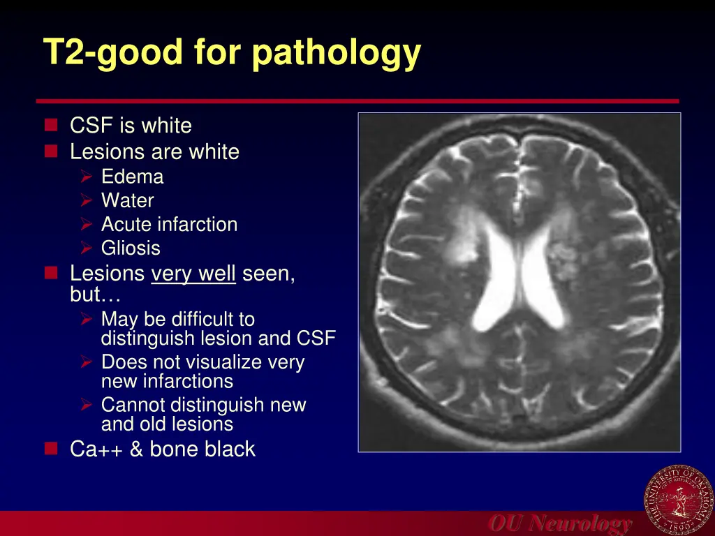 t2 good for pathology