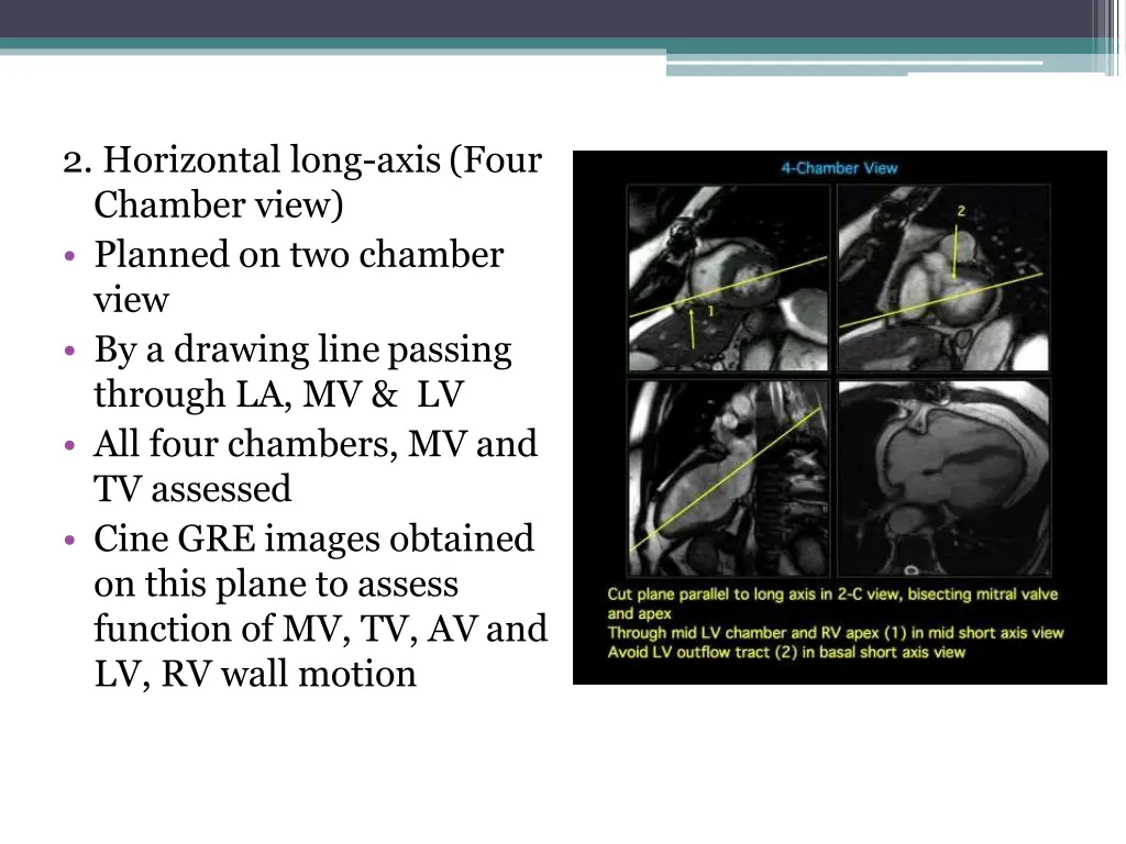 2 horizontal long axis four chamber view planned