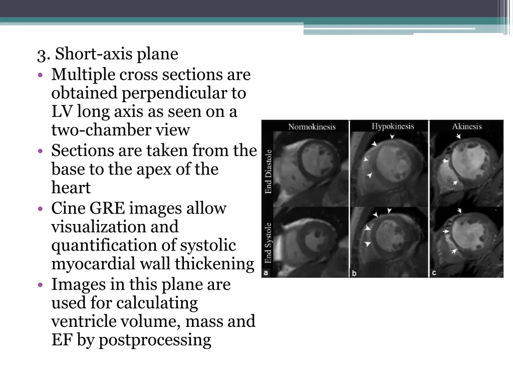 3 short axis plane multiple cross sections