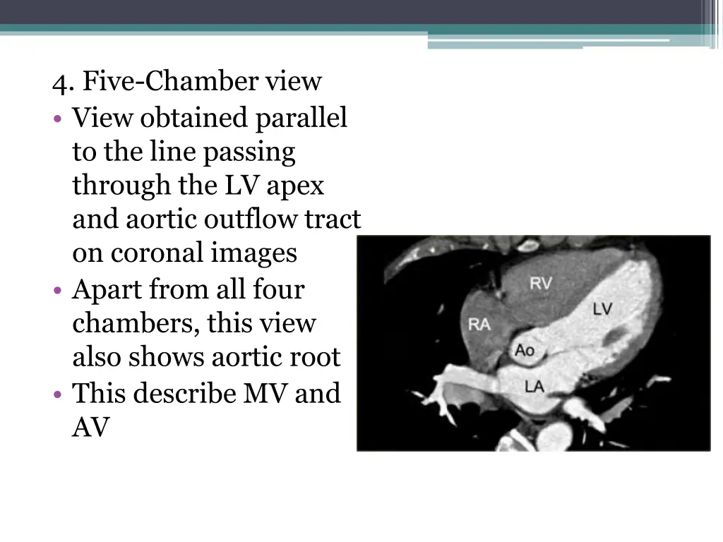 4 five chamber view view obtained parallel