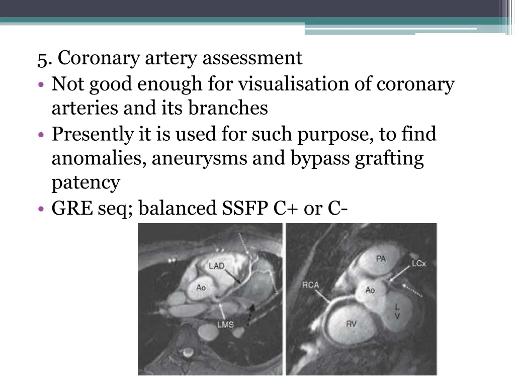 5 coronary artery assessment not good enough