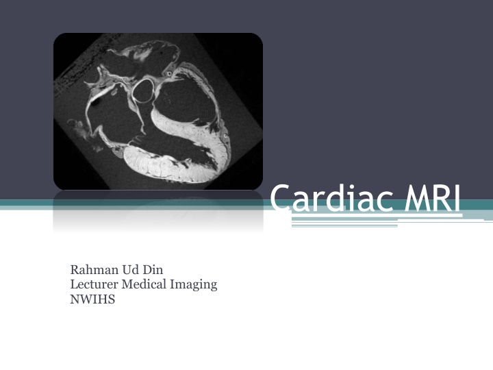 cardiac mri