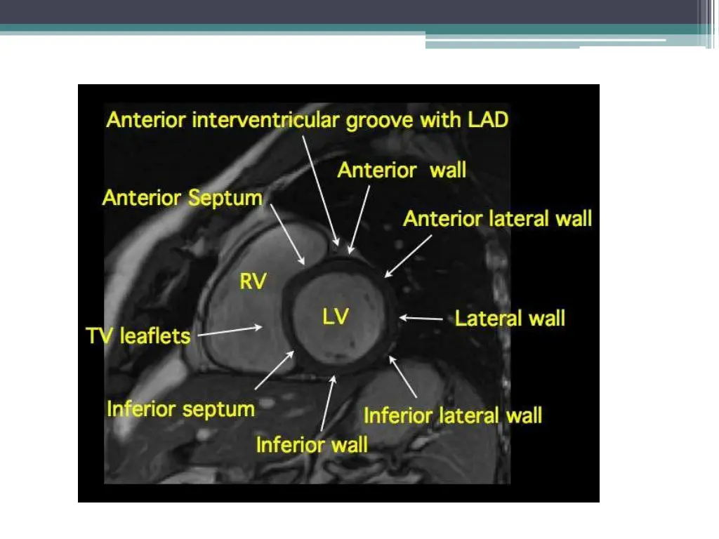 slide10